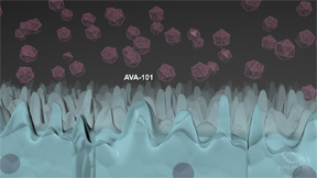 AVA-101 is injected into the eye in a short surgical procedure. Photo 2